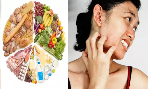 உடலில் அரிப்பை தடுக்கும் உணவுவகைகள்