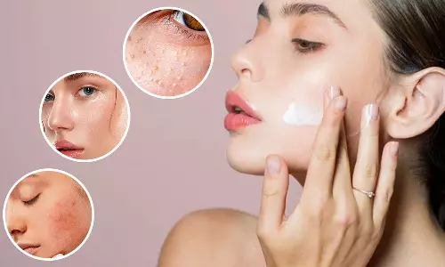 சரும பொலிவை அதிகரிக்கும் இயற்கை மாய்ஸ்சுரைசர்கள்