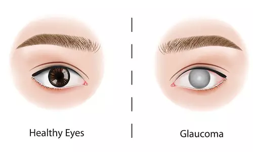 கம்ப்யூட்டர் மற்றும் செல்போன் அதிகம் உபயோகிப்பதால் கண்களில் பிரஷர் வருமா...?