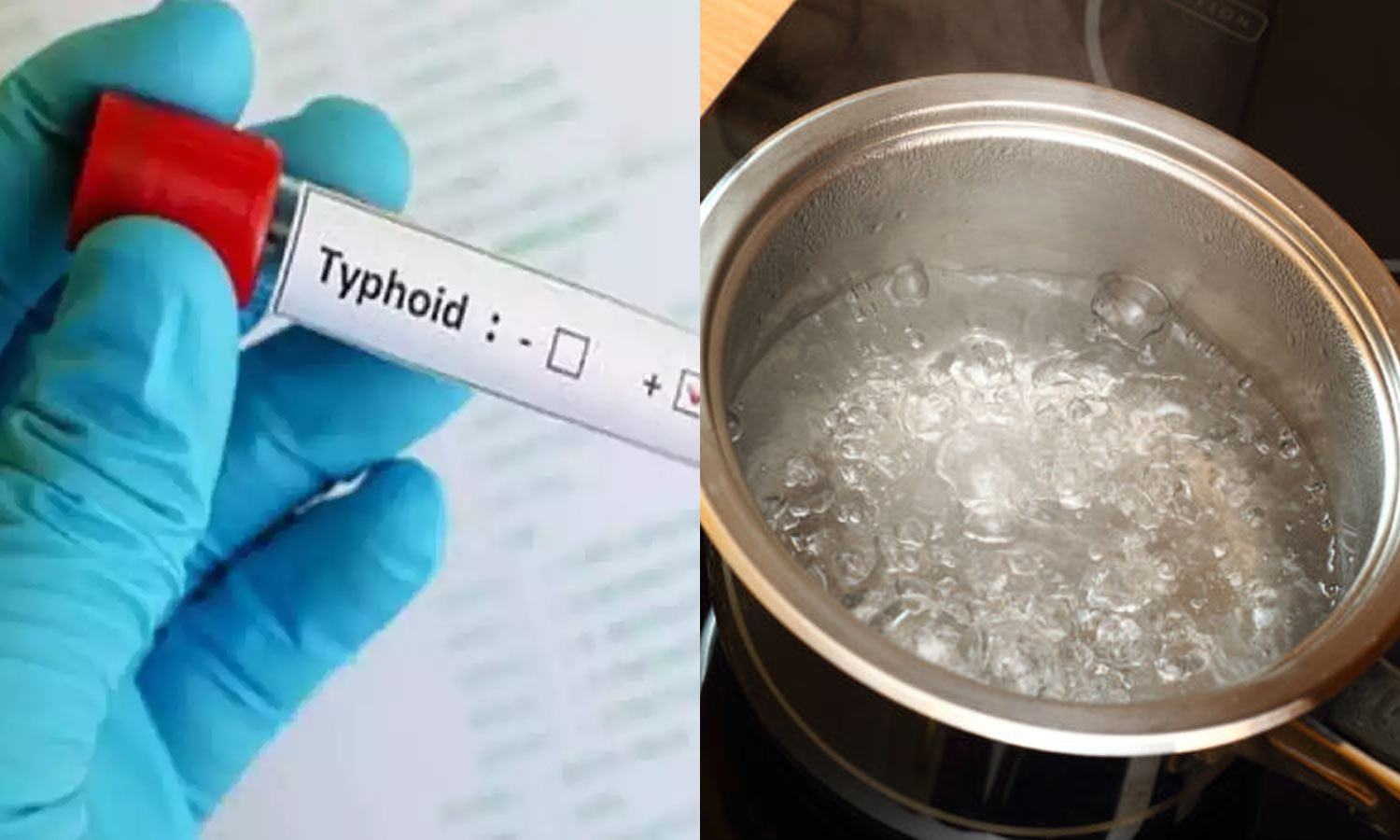 சென்னையில் அதிகரிக்கும் டைபாய்டு பாதிப்பு: தண்ணீரை காய்ச்சி குடிக்க டாக்டர்கள் அறிவுறுத்தல்