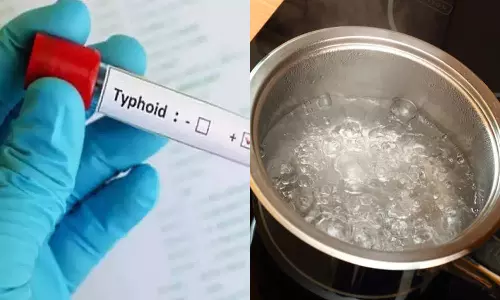 சென்னையில் அதிகரிக்கும் டைபாய்டு பாதிப்பு: தண்ணீரை காய்ச்சி குடிக்க டாக்டர்கள் அறிவுறுத்தல்