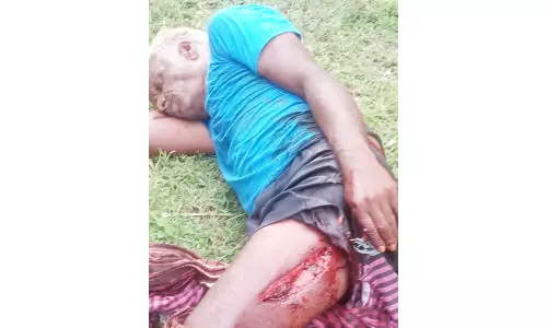 காட்டு யானை தாக்கியதில் விவசாயி படுகாயம்