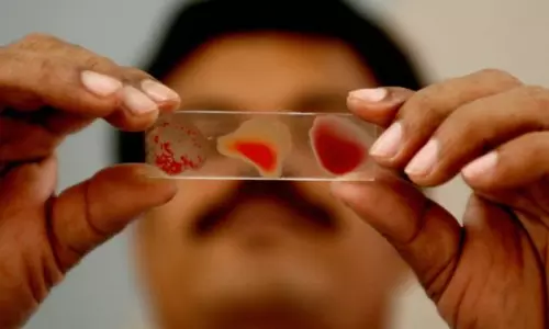 பொதுமக்களுக்கு ரத்த பரிசோதனை