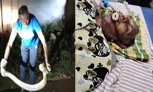 பாம்பு பிடி மன்னனை 2 முறை கடித்த பாம்பு- ஆஸ்பத்திரியில் தீவிர சிகிச்சை