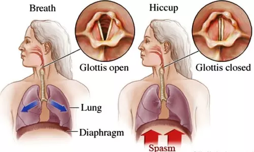 விக்கலும், சில சுவாரசியமான விஷங்களும்...!