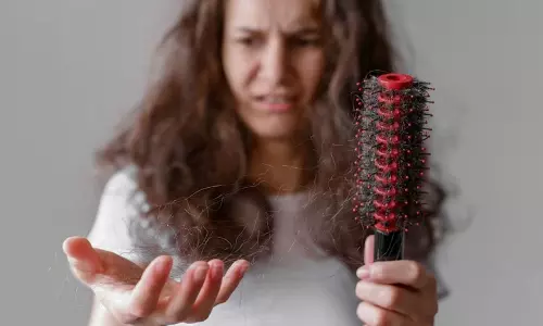 தலை முடி உதிர்வதைத் தடுக்கும் வழி முறைகள்