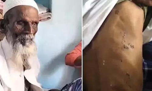 ஜெய் ஸ்ரீராம் என சொல்ல மறுத்த இஸ்லாமியரை தாக்கி, தாடியில் தீ வைத்த மர்ம நபர்கள்- போலீஸ் விசாரணை