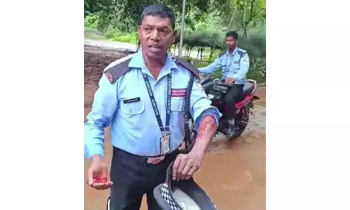 பல்கலைக்கழக காவலாளியை கடித்து குதறிய நாய்