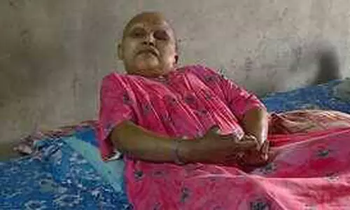 அரிய வகை நோய் பாதிக்கப்பட்டு கை விரல்கள் சிதைந்த பெண்ணுக்கு ஆதார் கார்டு