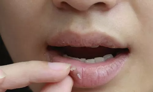 அடிக்கடி நாக்கு வறண்டு தாகம் எடுக்கிறதா...?