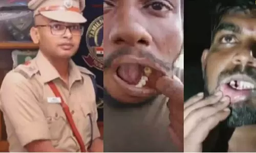 பல் பிடுங்கிய விவகாரம்: போலீஸ் அதிகாரி பல்வீர்சிங் உள்பட 14 பேர் கோர்ட்டில் ஆஜர்