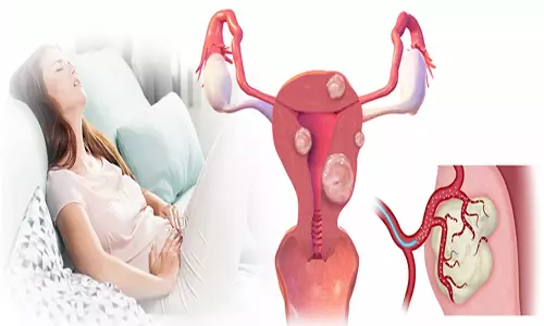 கருத்தரிப்பதை பாதிக்குமா ஃபைப்ராய்டு கட்டி?