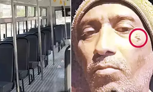 பஸ்சில் சீட் கிடைக்காததால் கண்டக்டரின் கன்னத்தை கடித்த வாலிபர் ரத்தம் கொட்டியதால் பயணிகள் அதிர்ச்சி