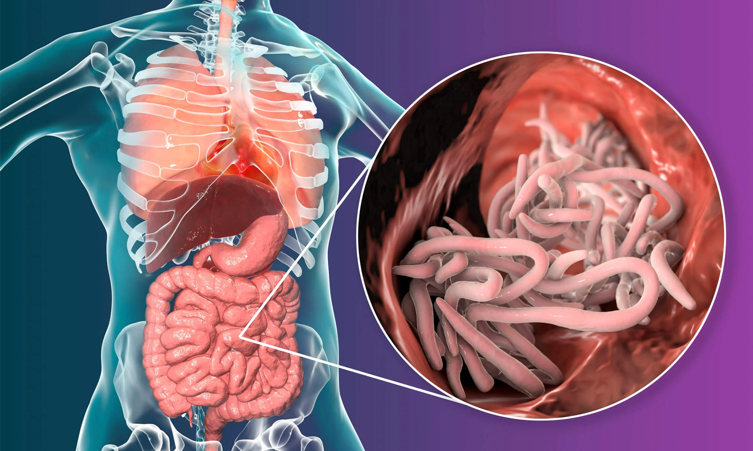 குடற்புழுக்களை ஒழிக்கும் இயற்கை வழிமுறைகள்