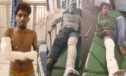 மருந்து கடை அதிபர் கொலை: கைதான 3 வாலிபர்களின் கை-காலில் மாவு கட்டு