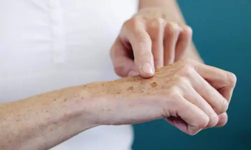 முதுமையில் தோல் நோய்களும், தீர்வுகளும்...