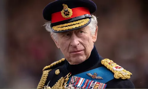 புரோஸ்டேட் சுரப்பி வீக்கம் - சிகிச்சைக்கு தயாராகும் அரசர் சார்லஸ்