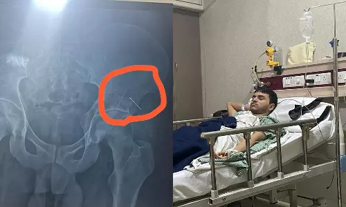 தடுப்பூசி போட்டபோது மாணவரின் இடுப்பில் ஊசி முறிந்து உடலுக்குள் சென்றது: போலீசில் புகார்