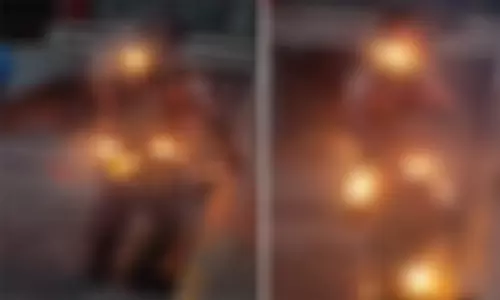 போலீசார் செல்போனை பிடுங்கியதால் தீ வைத்துக்கொண்ட வாலிபர்