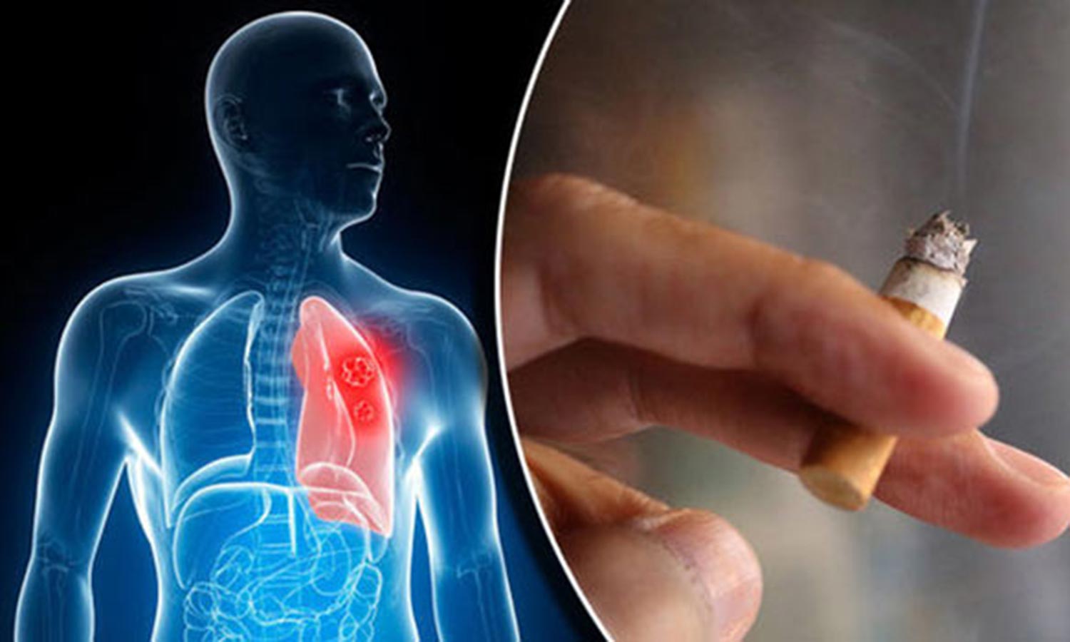 40 வயதிற்குள் புகைப்பிடிப்பதை நிறுத்தினால் ஆயுள் கூடும்- புதிய ஆய்வில்