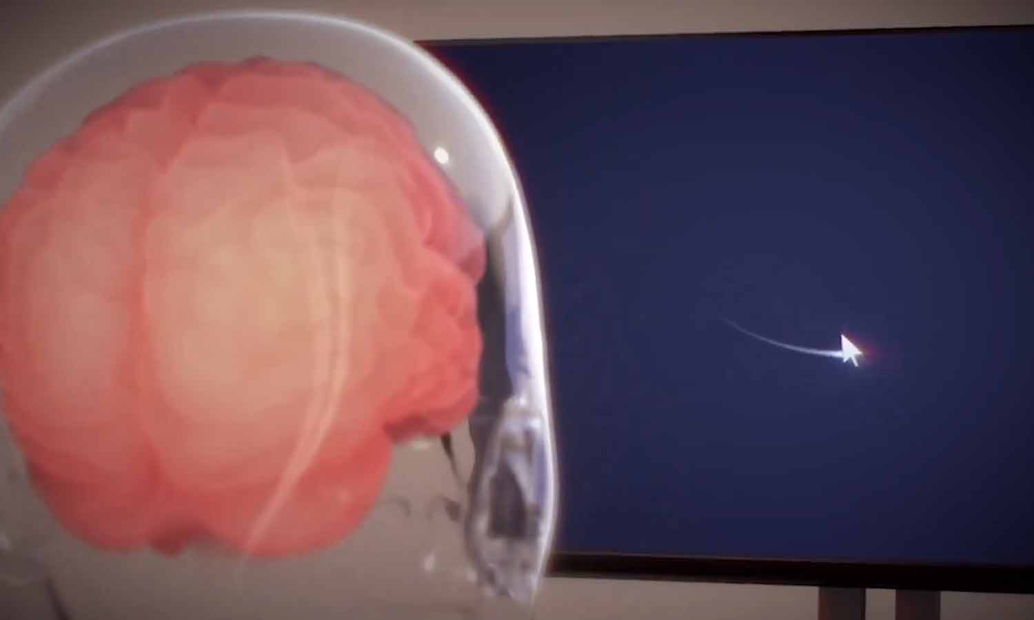 மூளையில் சிப் பொருத்தப்பட்ட நபர் எண்ணங்களால் கம்ப்யூட்டர் மவுஸ்-ஐ இயக்குகிறார் - எலான் மஸ்க்