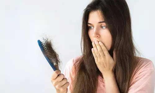 முடி கொட்டுவதை தடுக்க பயனுள்ள சில டிப்ஸ்....!