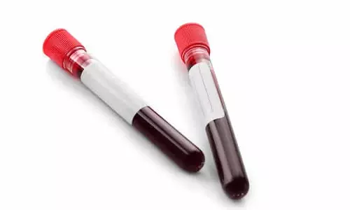 புதுச்சேரியில் படுகொலை செய்யப்பட்ட சிறுமியின் பெற்றோரிடம் ரத்த மாதிரி சேகரிப்பு