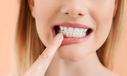 பற்களை பாதுகாக்க கடைபிடிக்க வேண்டிய வழிமுறைகள்!