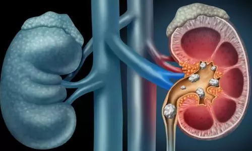 முதுமையில் சிறுநீரகக் கல்லடைப்பும், தீர்வுகளும்...