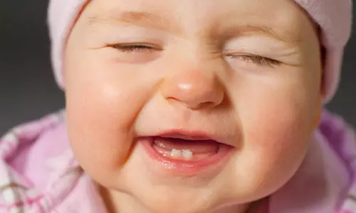 குழந்தைகளின் பற்களை சீரமைத்தல்