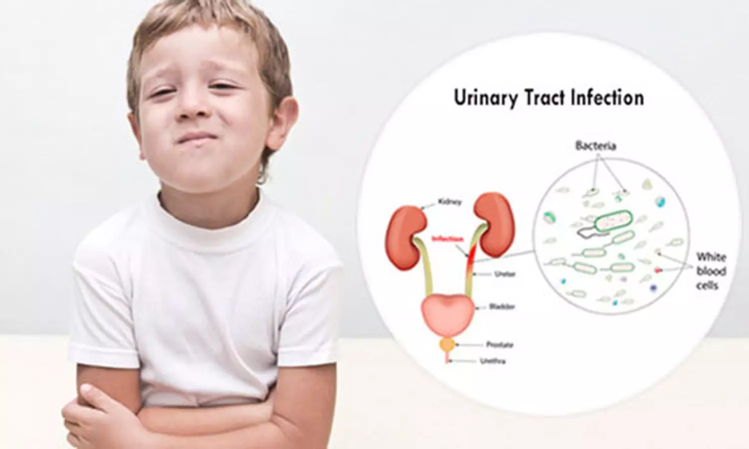 குழந்தைகளை பாதிக்கும் சிறுநீர் கிருமி தொற்று குழந்தைகளை பாதிக்கும் சிறுநீர் கிருமி தொற்று