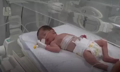 இஸ்ரேல் தாக்குதலில் பலி: இறந்த கர்ப்பிணி வயிற்றிலிருந்து குழந்தையை உயிருடன் எடுத்தனர்