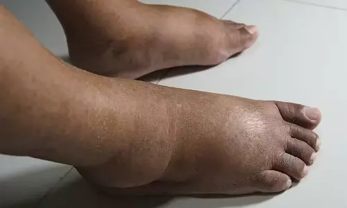 நின்றுகொண்டே வேலை செய்பவரா நீங்கள்...? இதை செய்ய மறக்காதீங்க!