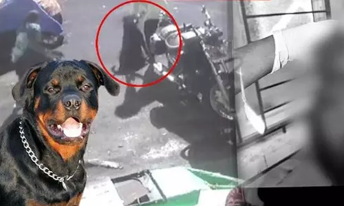 நாய் கடித்த சிறுமிக்கு 9-ம் தேதி அறுவை சிகிச்சை - சிறுமியின் தந்தை தகவல்