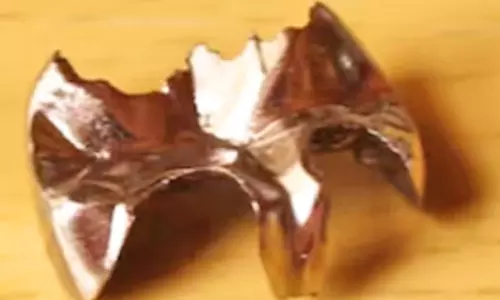 பற்களை திருடி விற்று கோடீஸ்வரரான டாக்டர்