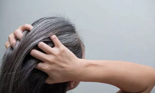 இளநரை பிரச்சனையும் இயற்கை முறையில் தீர்வும்