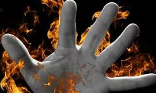 மலர்ந்த இடத்திலேயே கருகிய காதல் - காதலனை உயிருடன் எரித்து காதலியும் தீக்குளிப்பு