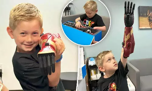 அயர்ன்மேனாக மாறிய 5 வயது சிறுவன்: இடது கை இல்லாமல் பிறந்தவருக்கு பயோனிக் கை பொருத்தம்