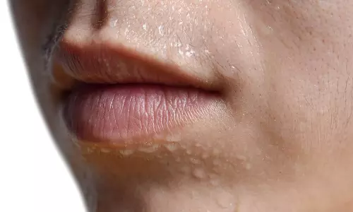 முகத்தில் அதிகம் வியர்க்க காரணம் தெரியுமா?