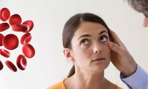 இரத்த சோகை யாரை பாதிக்கும்?