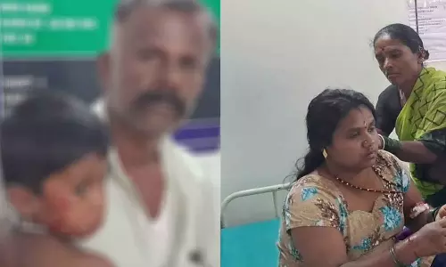 தெருநாய் கடித்து காயமடைந்த தாய்-மகளுக்கு சிகிச்சை