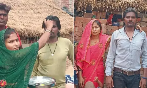 உடைந்த பல்- இன்ஸ்டாகிராம் ரீல்ஸ்: ஒன்று சேர்ந்த அண்ணன்- தங்கை