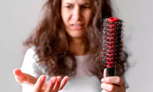 பருவமழை காலங்களில் முடி உதிர்வை தடுப்பது எப்படி?