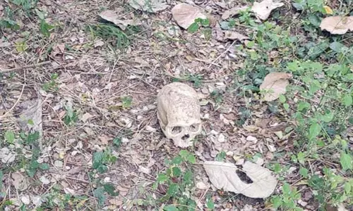 கோவில் குளத்தில் மனித மண்டை ஓடு-எலும்பு துண்டுகள்: போலீசார் விசாரணை