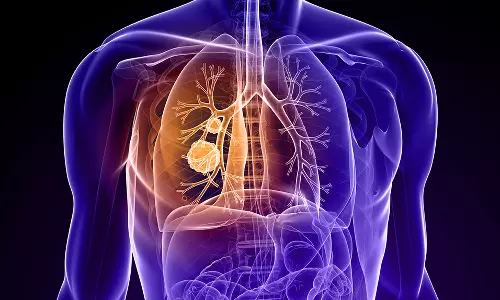 புகை பிடிக்காதவர்களுக்கும் புற்றுநோய் பாதிப்பு.. என்ன காரணம் தெரியுமா?