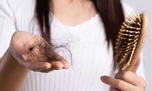 இளம் வயதிலேயே பெண்களுக்கு முடி உதிர காரணம் என்ன?