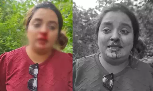 புனே: காருக்கு வழிவிடாததால் ஆத்திரம்... பெண்ணின் மூக்கை உடைத்த முதியவர் கைது