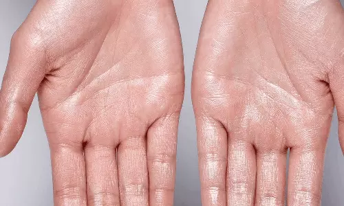 உள்ளங்கால், உள்ளங்கை வேர்ப்பதற்கான காரணம் இதுதானாம்