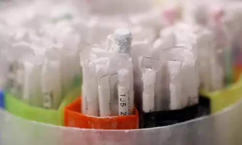 இங்கிலாந்தில் அதிகரிக்கும் விந்தணு தானம்: உலக அளவில் உடன்பிறப்பு இருக்கலாம் என எச்சரிக்கும் நாளிதழ்