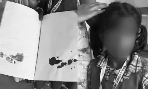 வீட்டுப்பாடம் செய்யாத சிறுமியை அறைந்த ஆசிரியர்..  காதில் ரத்தம் கொட்டியதால் பரபரப்பு - வீடியோ